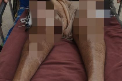 being-a-victim-of-an-israeli-attack,-this-man's-physical-condition-worsened-and-he-was-in-bed-for-almost-two-years