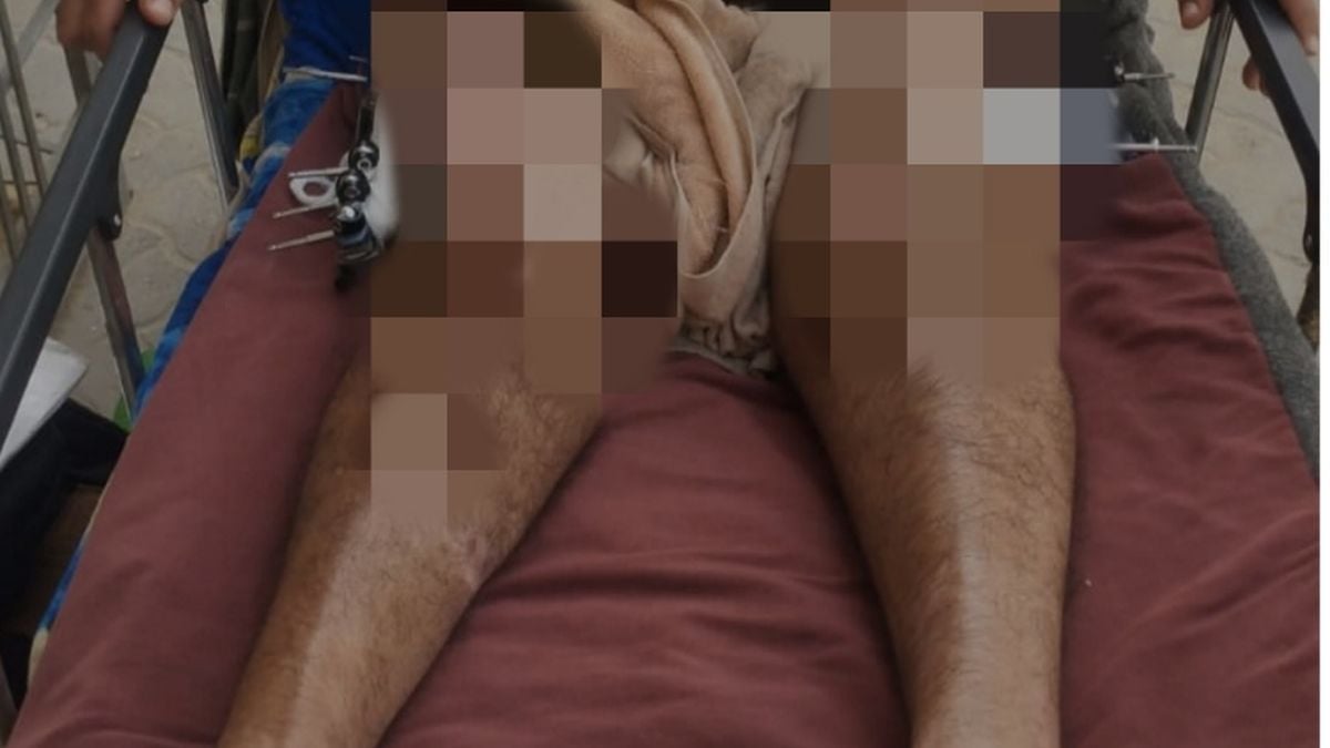 being-a-victim-of-an-israeli-attack,-this-man's-physical-condition-worsened-and-he-was-in-bed-for-almost-two-years