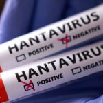 us-passenger-positive-for-andes-strain,-hantavirus-on-mv-hondius-highlighted
