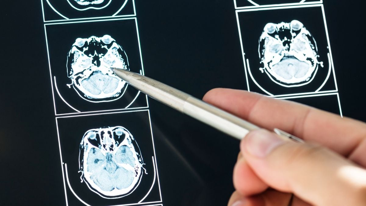 commemorating-world-brain-tumor-day-on-june-8,-increase-public-education-about-this-dangerous-disease