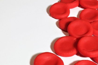 on-june-19,-there-is-world-sickle-cell-day,-know-about-this-observance-and-the-condition-of-sickle-cell-disease