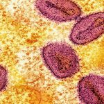 breaking-records,-first-case-of-h5-strain-bird-flu-found-in-australia,-allegedly-from-seabirds