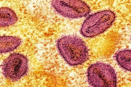 breaking-records,-first-case-of-h5-strain-bird-flu-found-in-australia,-allegedly-from-seabirds