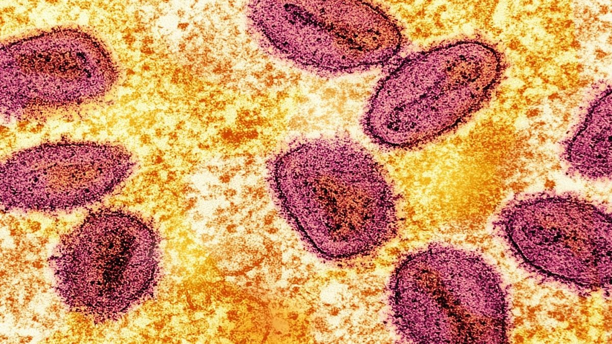 breaking-records,-first-case-of-h5-strain-bird-flu-found-in-australia,-allegedly-from-seabirds