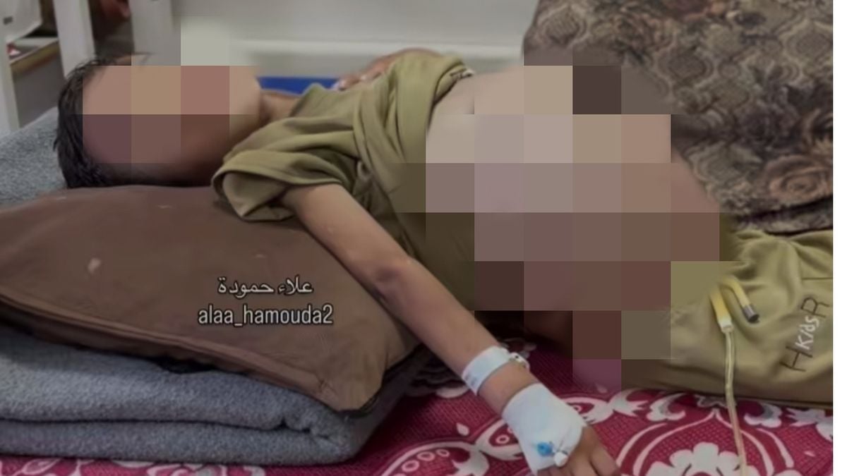 humanitarian-call,-this-6-year-old-child-in-palestine-has-stomach-swelling,-needs-immediate-treatment