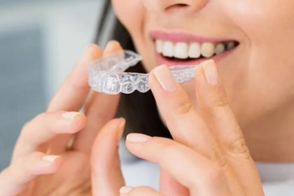 Clear Aligner