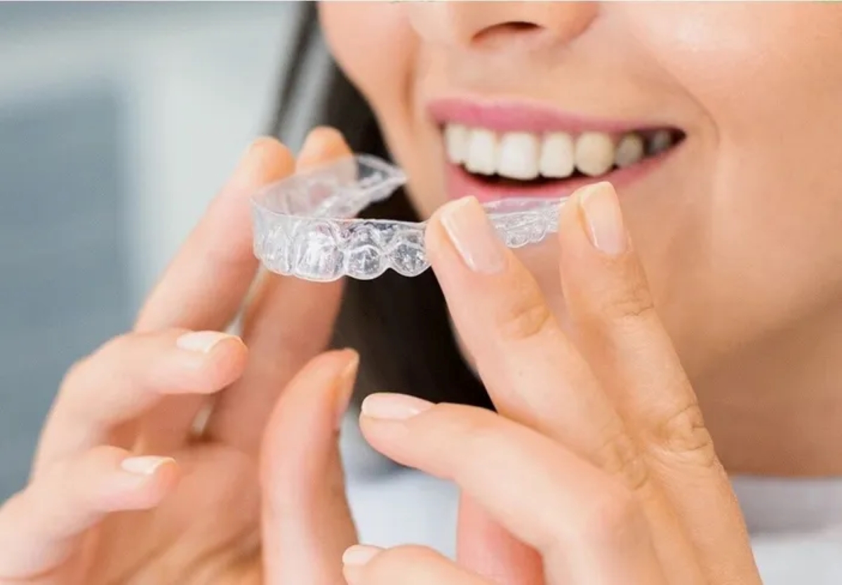 Clear Aligner